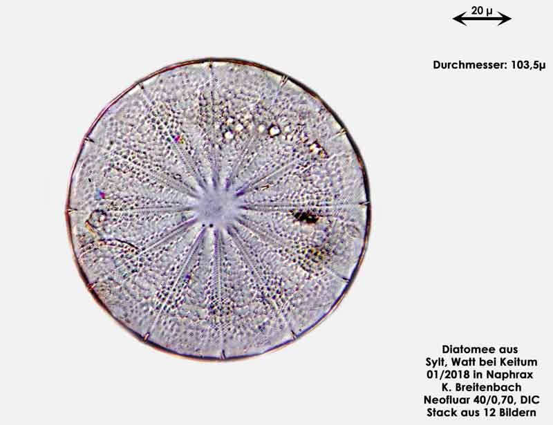 Bild 7 Diatomee aus Sylt/Keitum Watt, Art: Actinoptychus splendens (Shadbolt) Ralfs