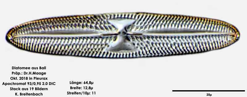 Bild 86 Diatomee aus Bali; Art: cf Trachyneis aspera (Ehrenberg) Cleve 1894