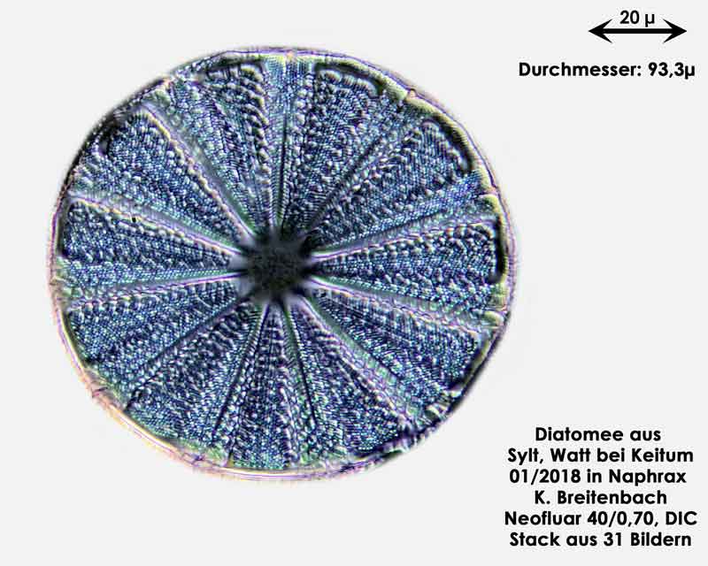 Bild 6 Diatomee aus Sylt/Keitum Watt, Art: Actinoptychus splendens (Shadbolt) Ralfs