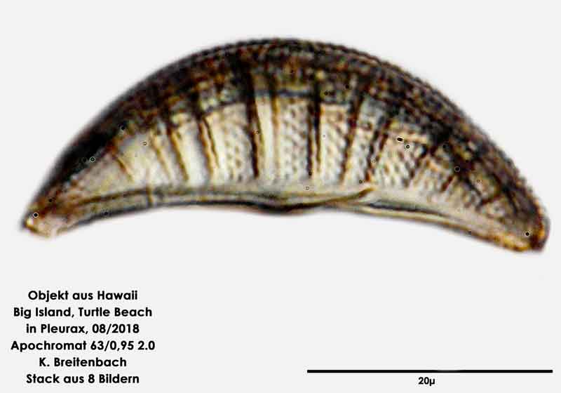 Bild 79 Diatomee aus Hawaii, Big Island, Turtle Beach. Art: Rhopalodia brebissonii Krammer 1987