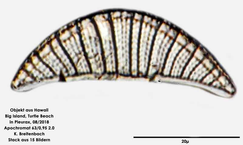 Bild 80 Diatomee aus Hawaii, Big Island, Turtle Beach. Art: Rhopalodia brebissonii Krammer 1987