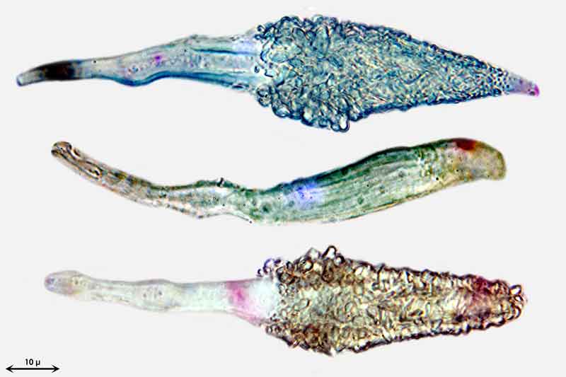 Bild 5 Phlebiopsis gigantea, Zystiden mit Kristallspitzen, eine Zystide nicht voll entwickelt