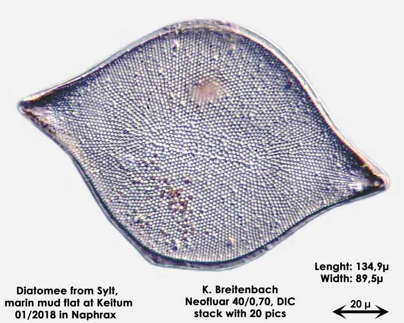 Bild 17a Diatomee aus Sylt/Keitum Watt, Art: Biddulphia rhombus (Ehrenberg) Smith 1854