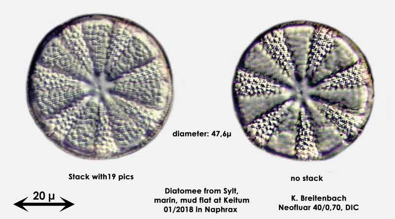 Bild 5 Diatomee aus Sylt/Keitum Watt, Art: Actinoptychus splendens (Shadbolt) Ralfs