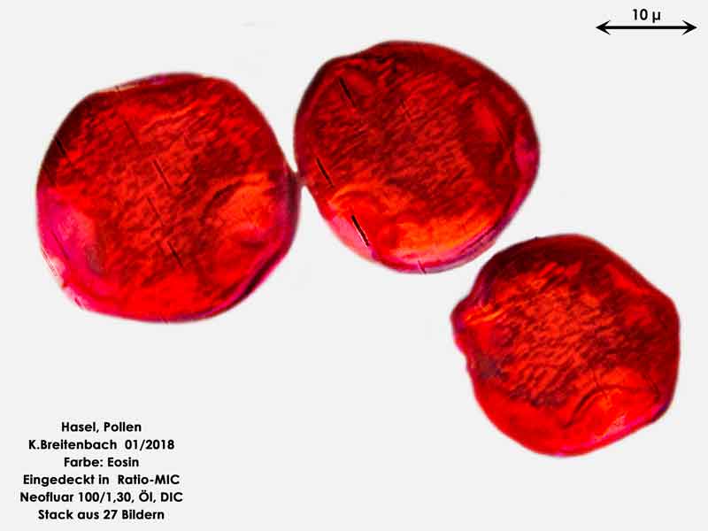 Bild 8 Hasel-Pollen Eosin gefärbt in Ratio-MIC 1000 fach vergrößert