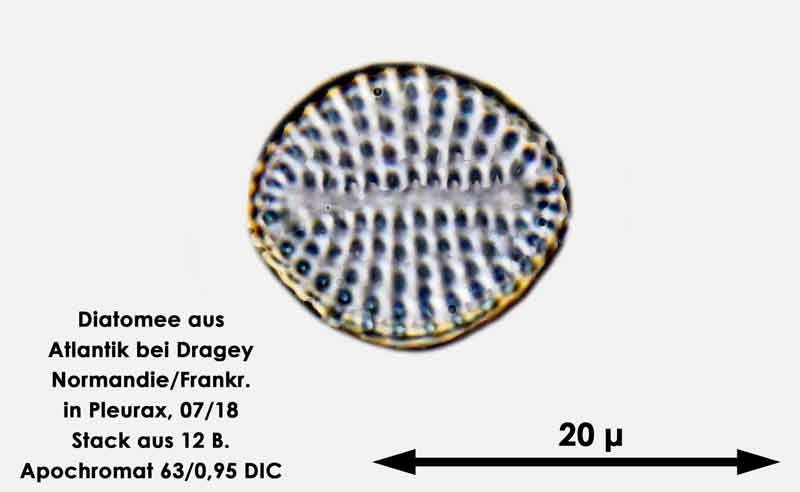 Bild 62 Diatomee aus dem Atlantik bei Draghey de Monton (Normandie). Art: Rhaphoneis amphiceros (Ehrenberg) Ehrenberg 1844