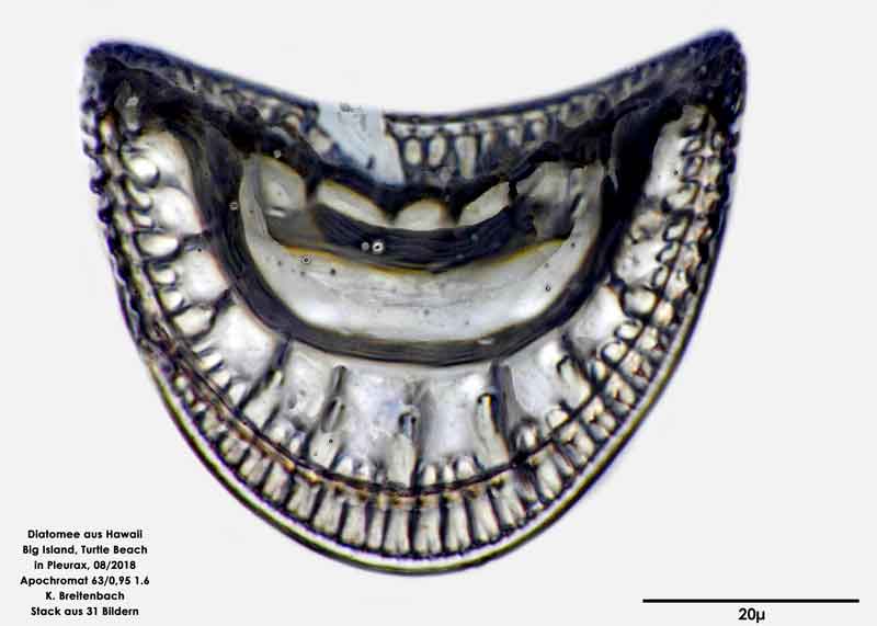 Bild 110 Diatomee aus Hawaii, Big Island, Turtle Beach. Gattung: konnte von mir nicht bestimmt werden