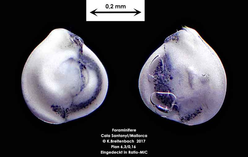 Bild 19 Foraminifere aus Mallorca Cala Santanyi, Art: Quinqueloculina sp.