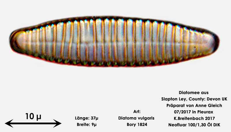 Bild 14 Diatomeen aus Slapton Ley, Devon UK; Art: Diatoma vulgaris Bory 1824