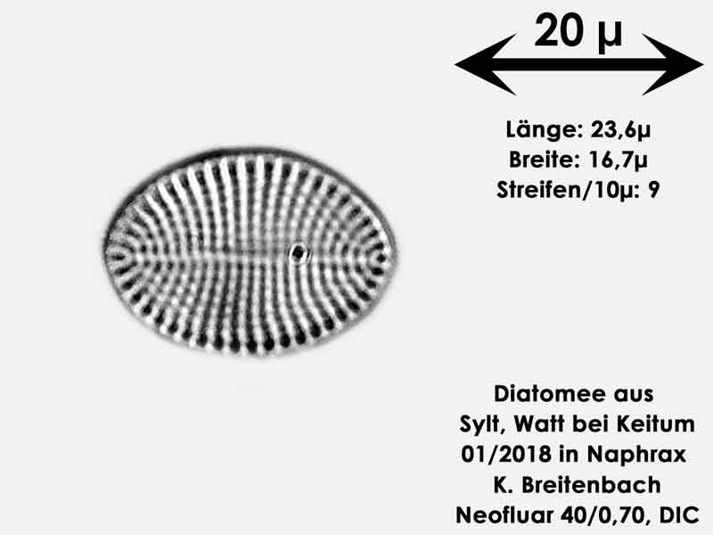 Bild 25 Diatomee aus Sylt/Keitum Watt, Art: Cocconeis scutellum Ehrenberg 1838