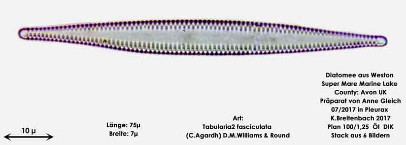 Bild 21 Diatomeen aus Weston Super Mare, UK Art: Tabularia fasciculata (C.Agardh) D.M.Williams & Round