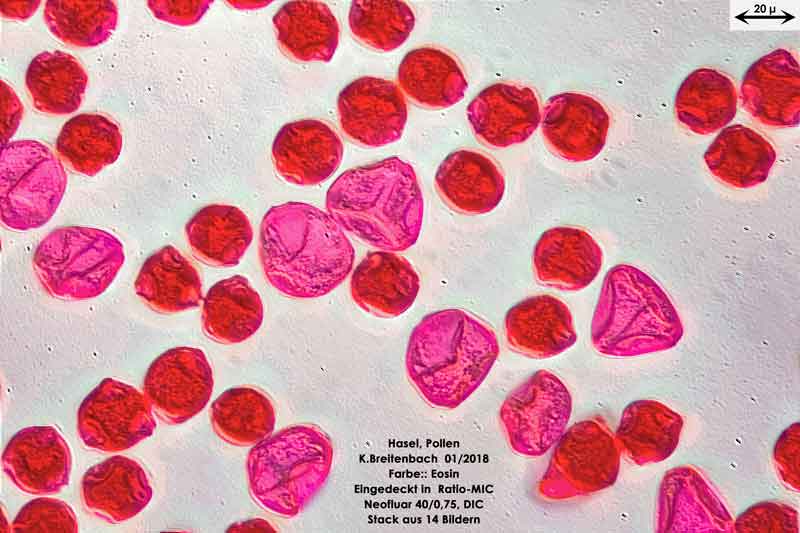 Bild 5 Hasel-Pollen Eosin gefärbt in Ratio-MIC 400 fach vergrößert