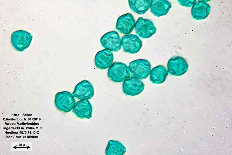 Bild 10 Hasel-Pollen Methylenblau gefärbt in Ratio-MIC 400 fach vergrößert