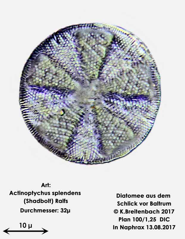 Bild 2 Diatomee aus dem Watt vor Baltrum Art: Actinoptychus splendens (Shadbolt) Ralfs