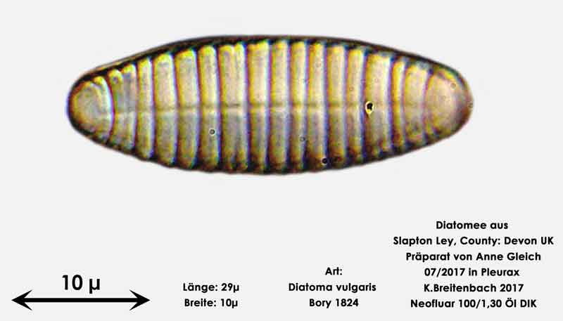 Bild 13 Diatomeen aus Slapton Ley, Devon UK; Art: Diatoma vulgaris Bory 1824