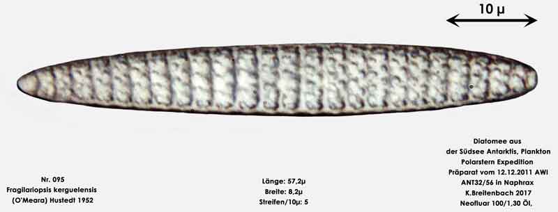 Bild 14 Art: Fragilariopsis kerguelensis (O'Meara) Hustedt 1952