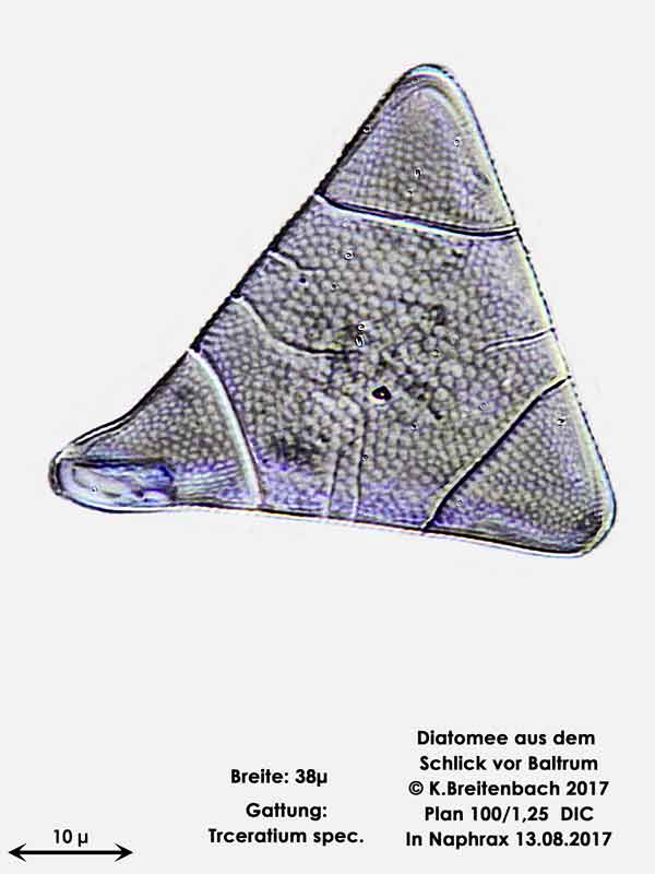 Bild 21 Diatomee aus dem Watt vor Baltrum; Gattung: Triceratum spec.