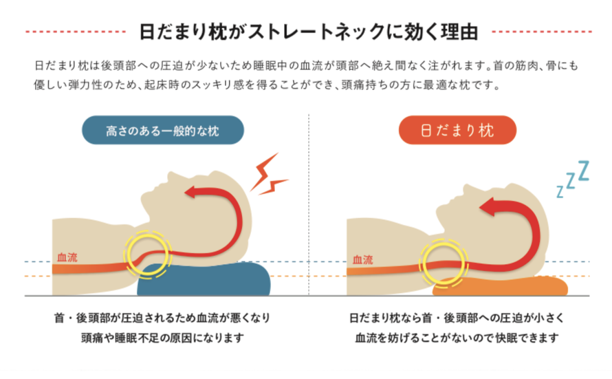 日だまり枕 - 瀬戸内市・頭痛専門治療の日だまりショットの効果 日だまり枕 - 瀬戸内市・頭痛専門治療の日だまりショットの効果