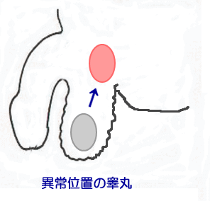 無精子症 睾丸診断 東京 埼玉 群馬の不妊症治療 子宝はり の日本ハリセンター 無精子症 睾丸診断 東京 埼玉 群馬の不妊症治療 子宝はり の日本ハリセンター