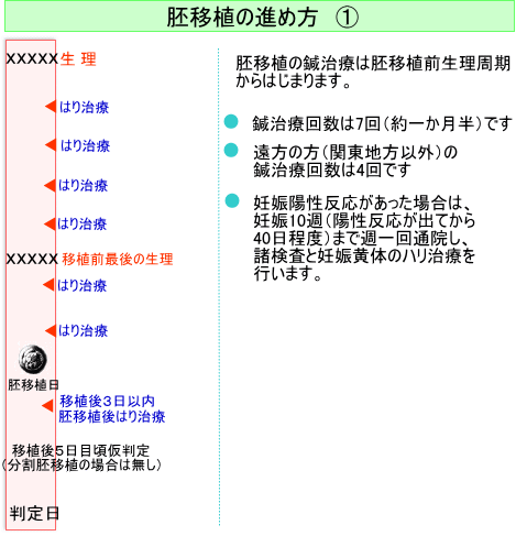 胚移植のはり治療とは 体外受精移植後のサポート治療 東京 埼玉 群馬の不妊症治療 子宝はり の日本ハリセンター 胚移植のはり治療とは 体外受精移植後のサポート治療 東京 埼玉 群馬の不妊症治療 子宝はり の日本ハリセンター