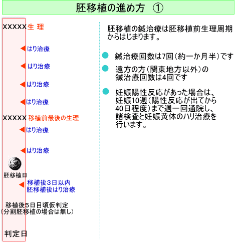 胚移植のはり治療とは 体外受精移植後のサポート治療 東京 埼玉 群馬の不妊症治療 子宝はり の日本ハリセンター