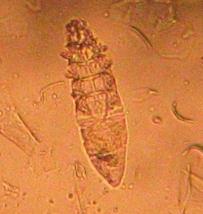 Demodexmilbe (Haarbalgmilbe) unter dem Mikroskop
