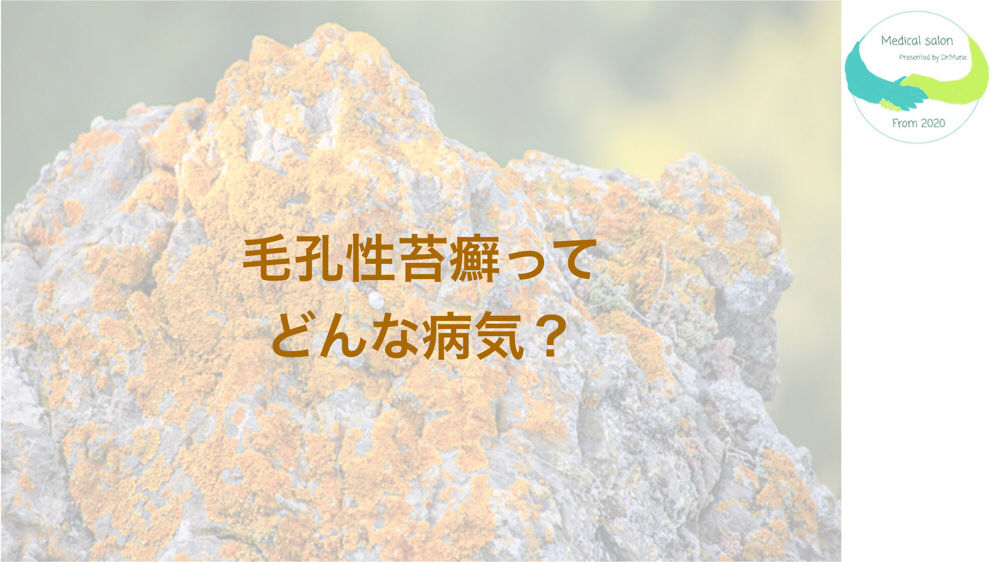 毛孔性苔癬ってどんな病気?