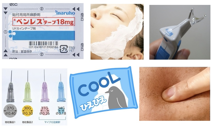針を刺す瞬間の痛みを減らすための工夫