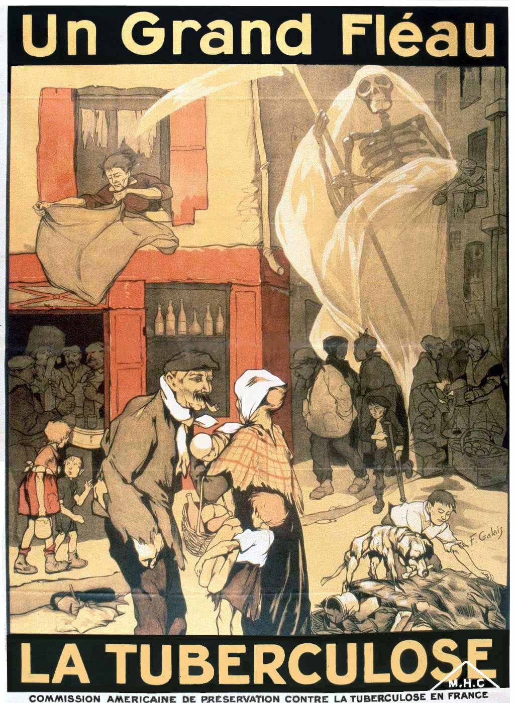 La tuberculose, un fléau