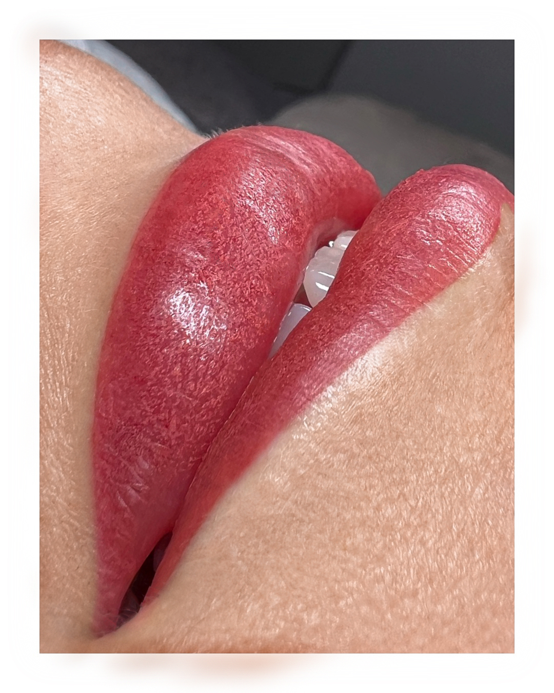 Lippen