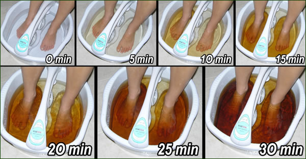 máquina de baño de pies para diabetes