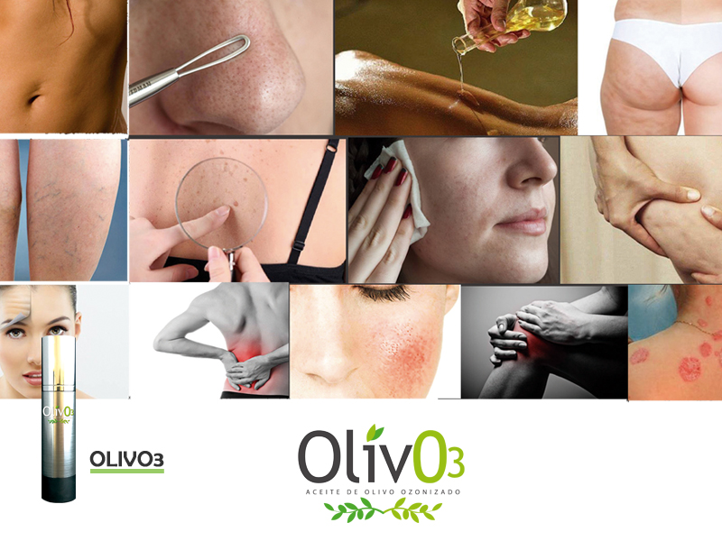 Olivo3