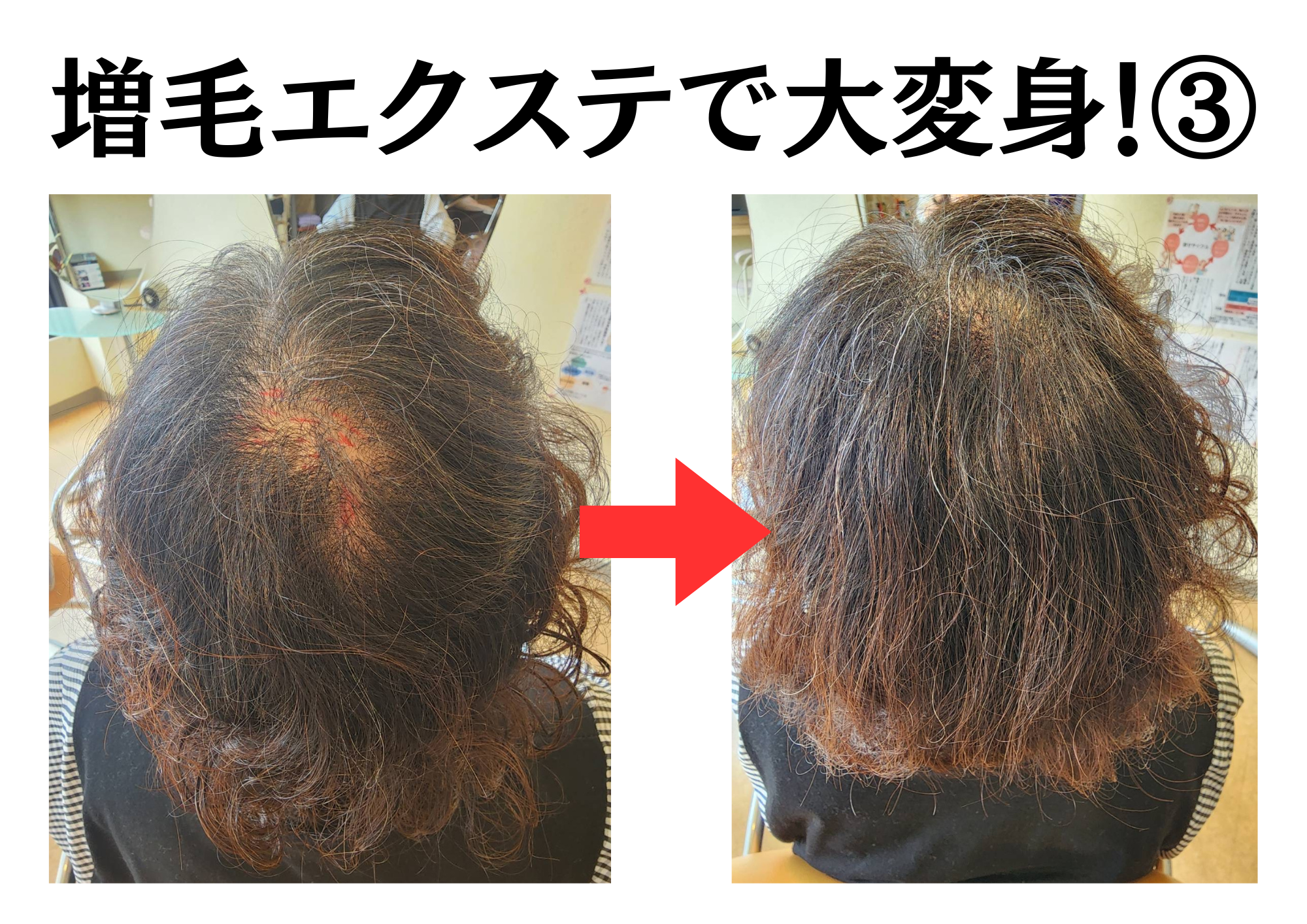 増毛エクステで大変身！③