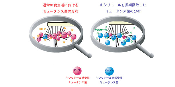 キシリトールを長期摂取したミュータンス菌の分布