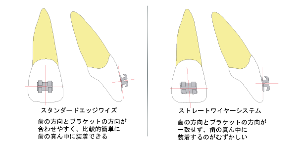 エッジワイズ比較１