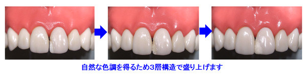 自然な色調を得るための３層構造で盛り上げます