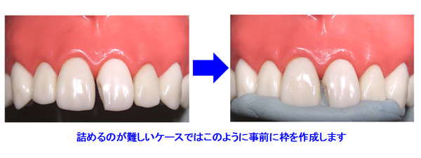 詰めるのが難しいケースではこのように事前に枠を作成します