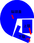 不正咬合者の典型的な頭と顎の骨格