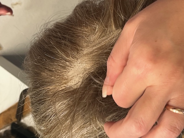 Reparatur arbeiten