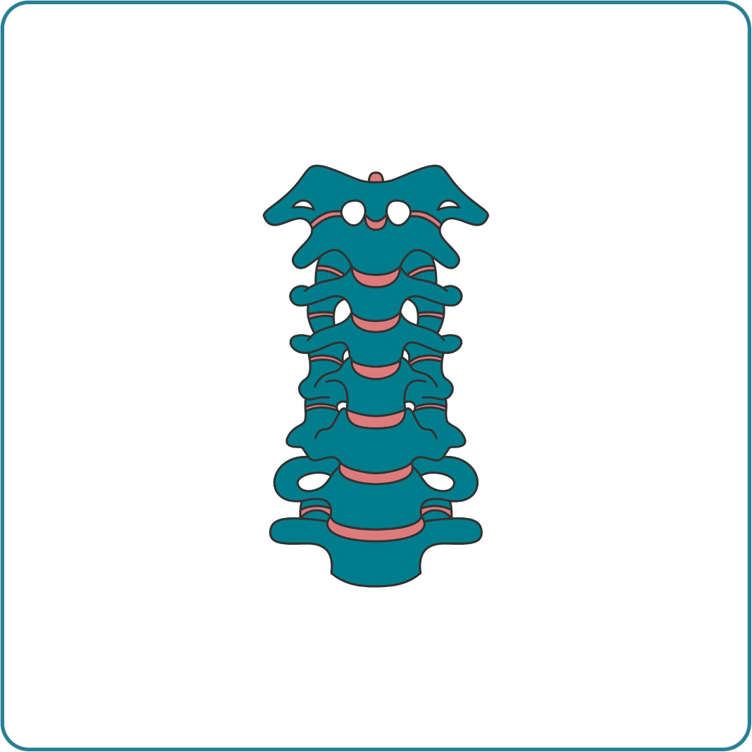 SPINALKANALSTENOSE