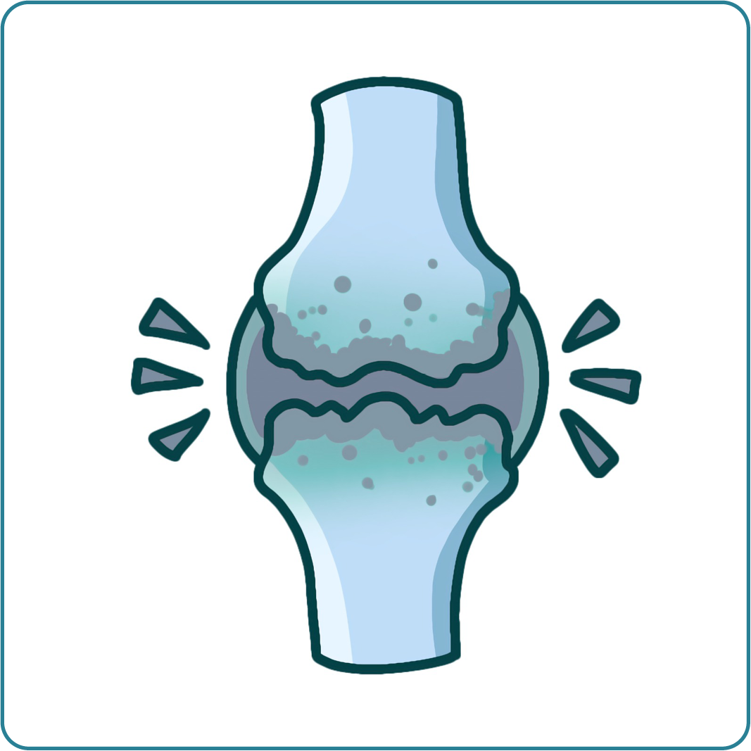 ARTHROSE