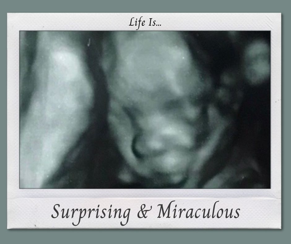 Life Is...Surprising & Miraculous