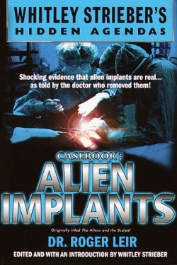 Casebook: Alien Implants by Roger K. Leir