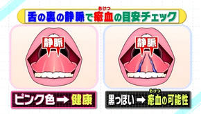 207 血行不良 平生堂整体院