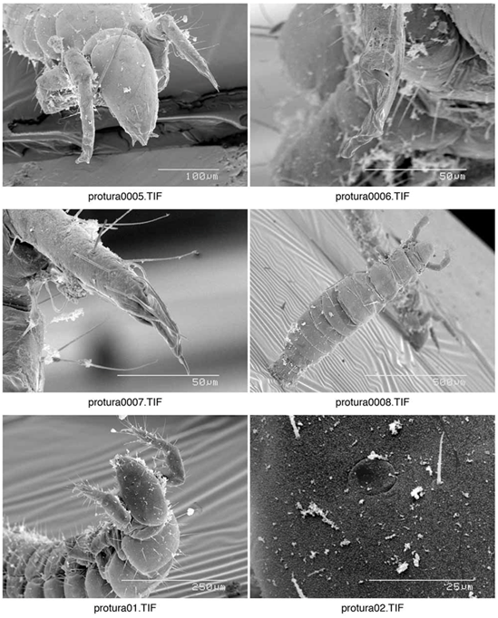 Figure 8 : série 2 de photographies d'un protoure vu au microscope électronique : GREGORY S. PAULSON, Ph.D.