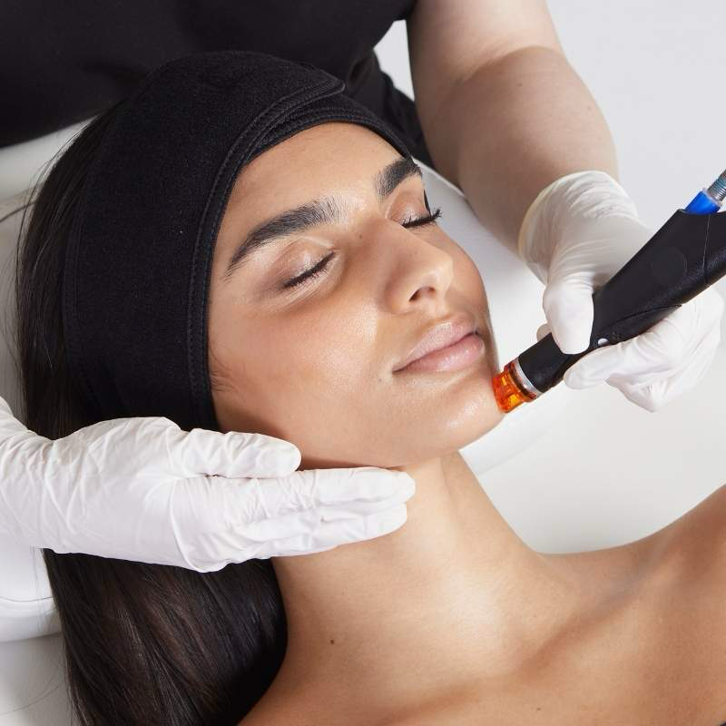 Hydrafacial Gesichtsbehandlung im Kosmetikstuio Canisius für professionelle Kosmetikbehandlungen 