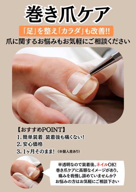 施術シーン