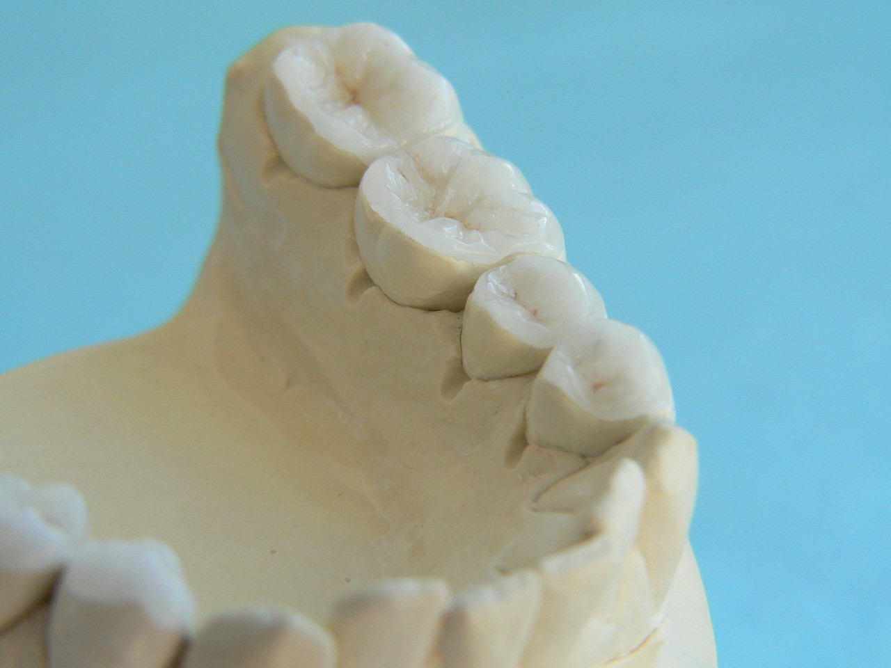 TableTopVeneers Dr. Richard Krause ist ein guter Zahnarzt für ästhetische Zahnheilkunde in