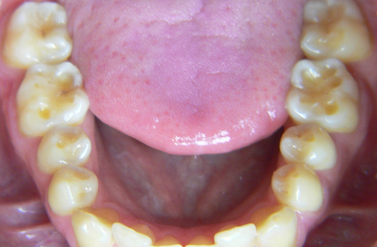 TableTopVeneers Dr. Richard Krause ist ein guter Zahnarzt für