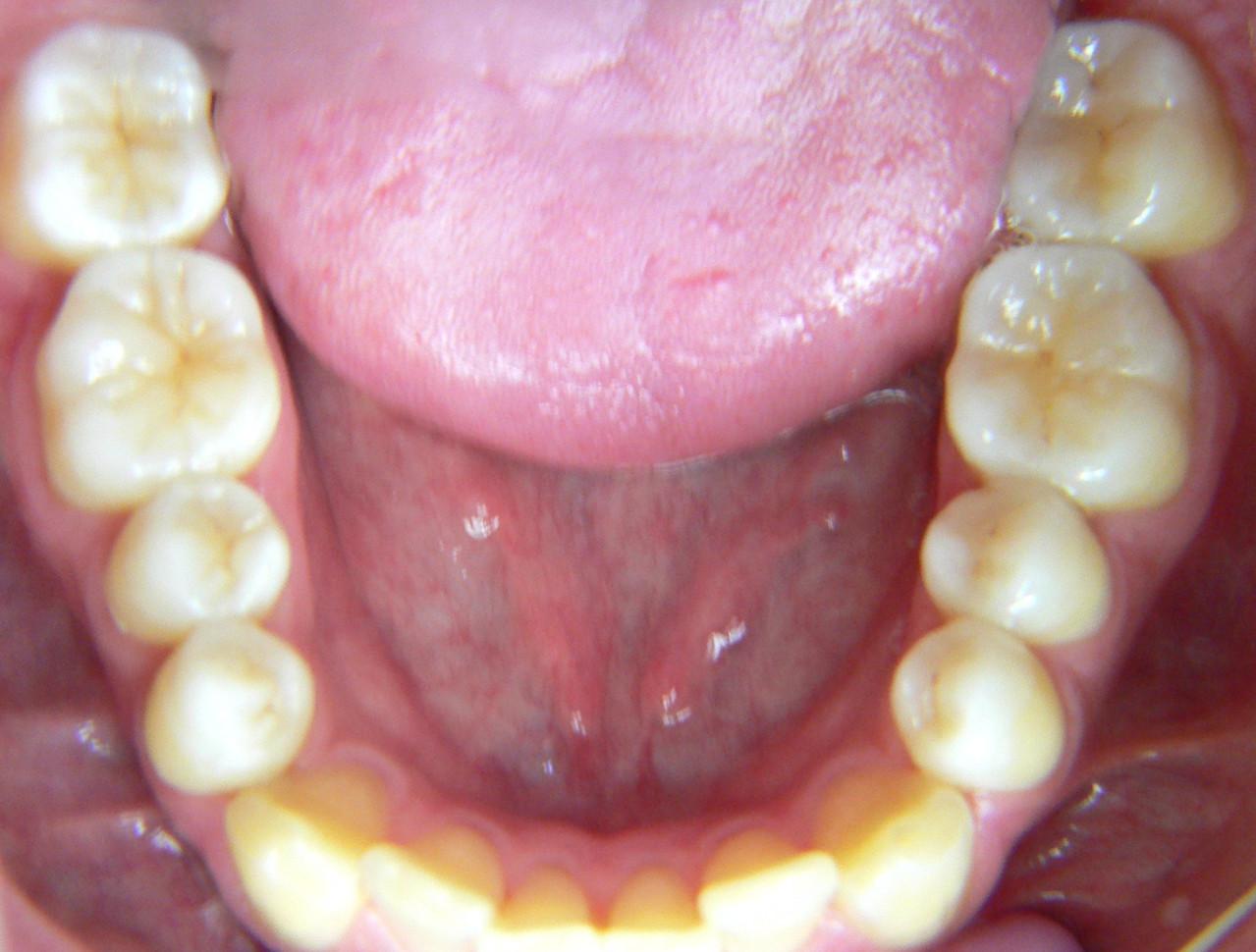 TableTopVeneers Dr. Richard Krause ist ein guter Zahnarzt für ästhetische Zahnheilkunde in